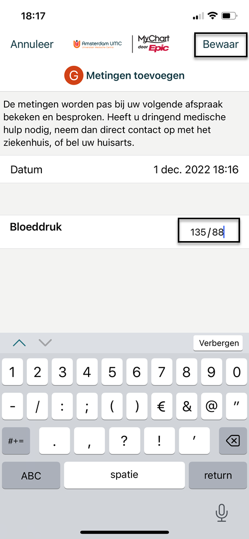 Stap 7
