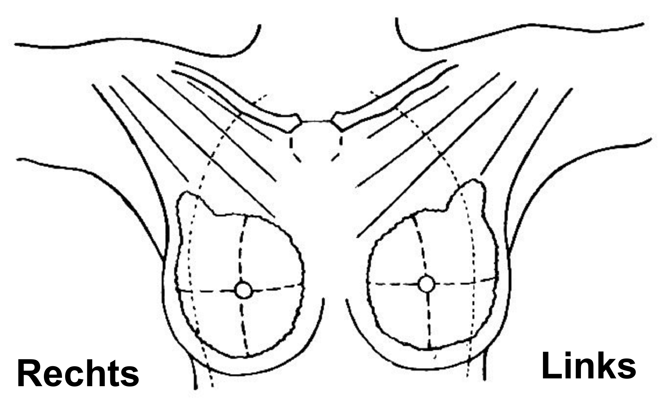 Schematische weergave mammae