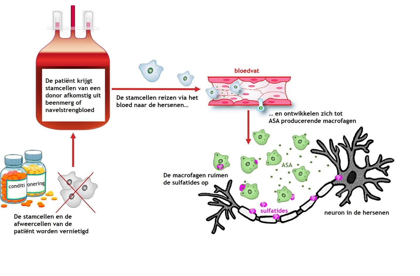 Stamceltransplantatie allogeen