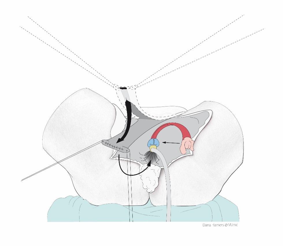 Afbeelding met schets, tekening, kunst, illustratie
Door AI gegenereerde inhoud is mogelijk onjuist.