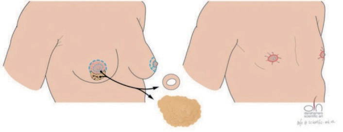Donut-techniek, Afbeelding