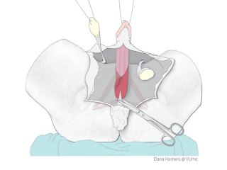 Picture 230, Afbeelding