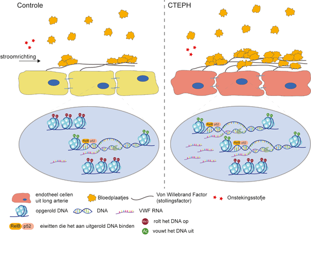 Overzicht CTEPH (Xue Manz, PhD Student, 2022)