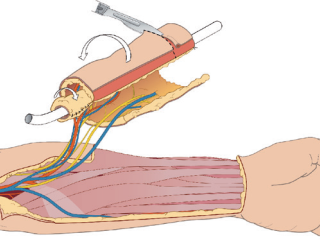 Picture 59, Afbeelding