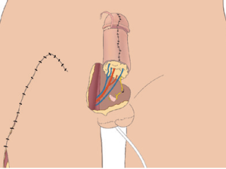 Picture 71, Afbeelding