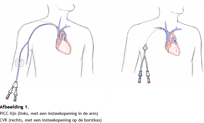 Afbeelding met schets, tekening, kunst, skelet