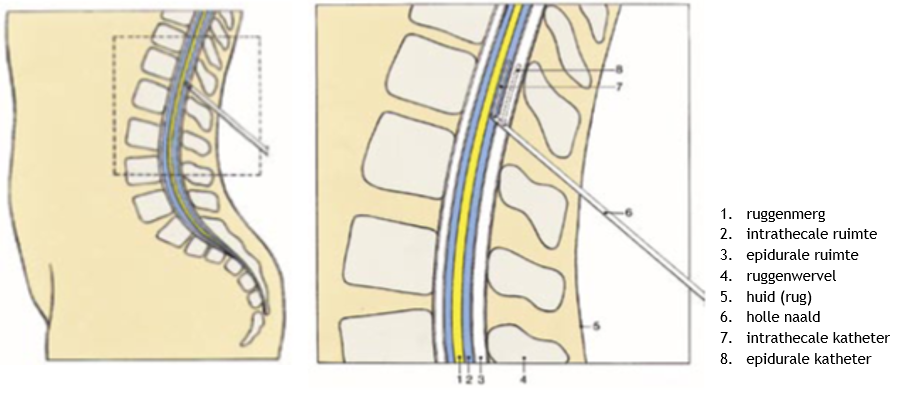 Afbeelding met kaart, skelet
