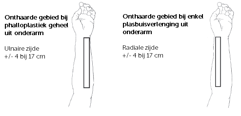 A hand with a line drawn on it
Description automatically generated, Afbeelding