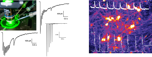 Meten van prikkelbalans in hersencellen van patiënten