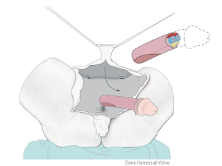 Picture 233, Afbeelding