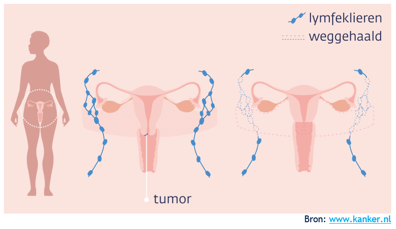 Afbeelding met schoeisel, schermopname, skelet
