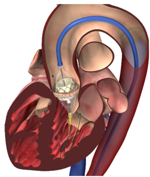 Afbeelding met tekenfilm, hoge hakken, kunst