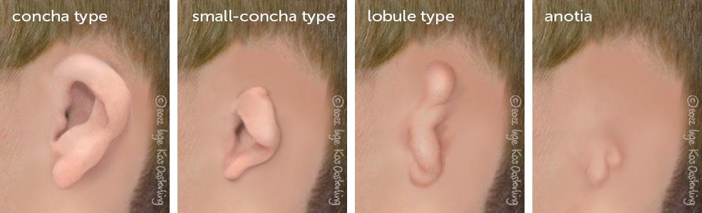 Microtie | Amsterdam UMC