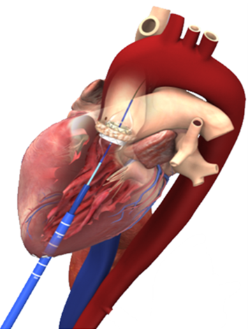 Afbeelding met tekenfilm, joint, rood, kunst
Door AI gegenereerde inhoud is mogelijk onjuist.