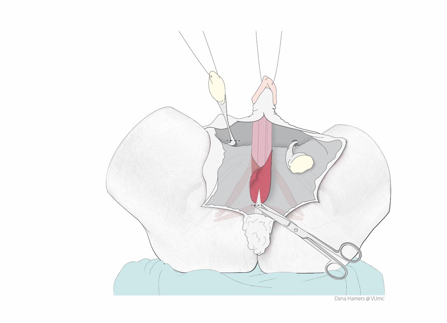 Afbeelding met schets, Kinderkunst, kunst, tekening
Door AI gegenereerde inhoud is mogelijk onjuist.