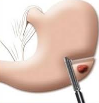 Afbeelding met schets, gereedschap
Door AI gegenereerde inhoud is mogelijk onjuist.