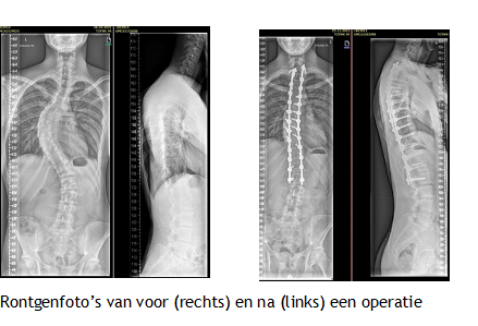 Afbeelding met röntgenfilm, Medische beeldbewerking, radiologie, radiografie
Door AI gegenereerde inhoud is mogelijk onjuist.