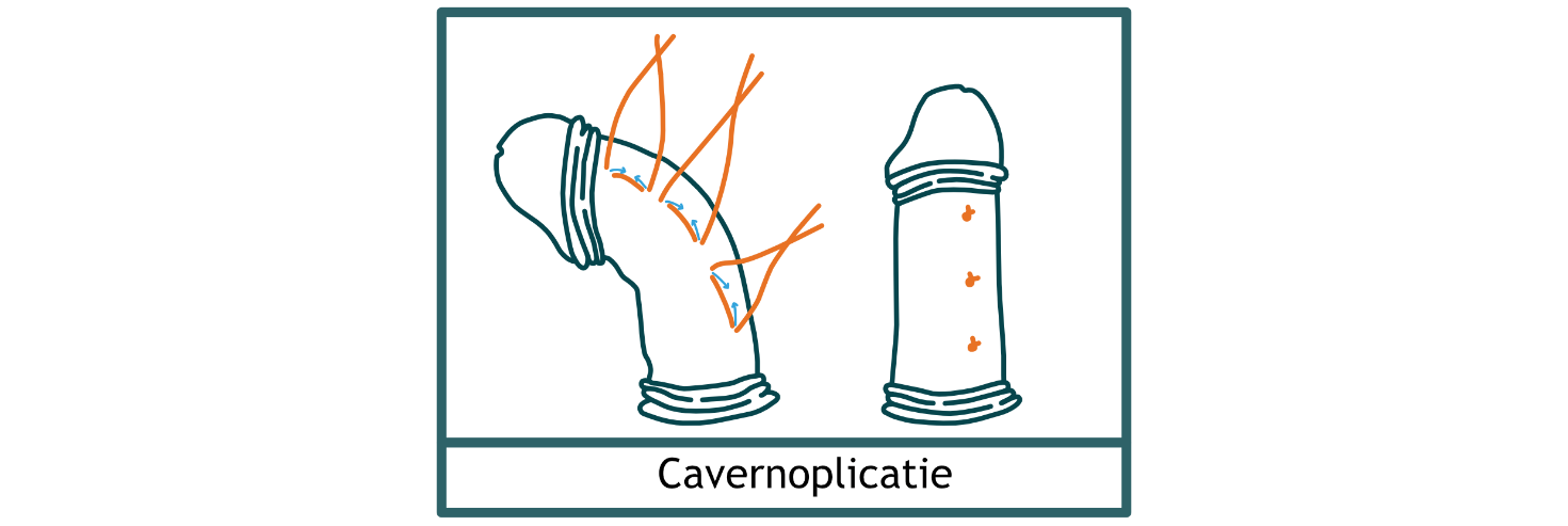 Afbeelding met tekening, schets, Kinderkunst, kunst
Automatisch gegenereerde beschrijving