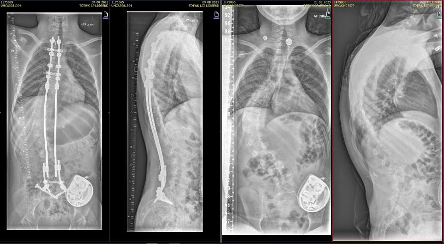 Afbeelding met röntgenfilm, Medische beeldbewerking, radiologie, radiografie
Automatisch gegenereerde beschrijving