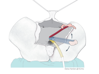 Picture 237, Afbeelding