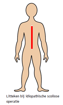 Afbeelding met joint, clipart, illustratie
Door AI gegenereerde inhoud is mogelijk onjuist.