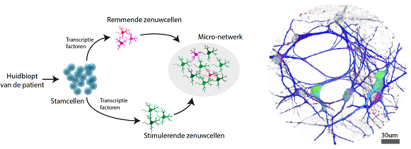 Hersencellen uit stamcellen van patiënten