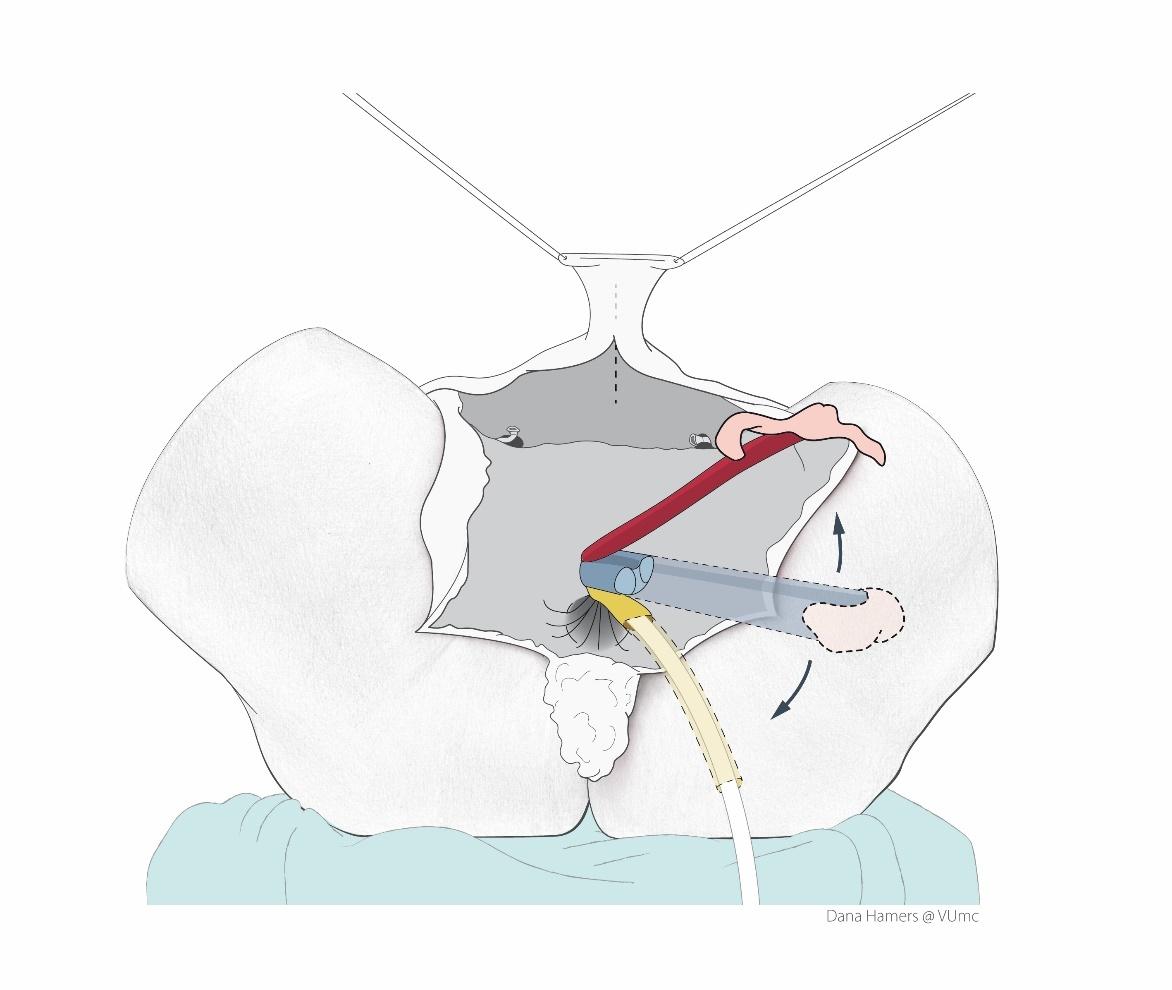 Afbeelding met schets, tekening, kaart, kunst
Door AI gegenereerde inhoud is mogelijk onjuist.