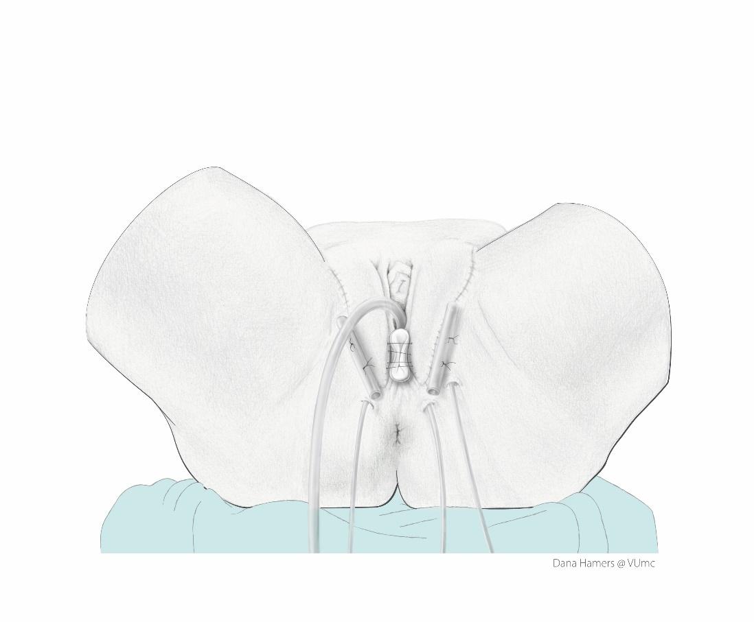 Afbeelding met schets, tekening, kunst
Door AI gegenereerde inhoud is mogelijk onjuist.