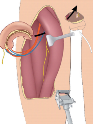 Picture 69, Afbeelding