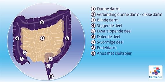 Endeldarmkanker en bestraling (radiotherapie)