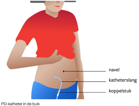 Afbeelding met joint, schouder, maag, spier
Door AI gegenereerde inhoud is mogelijk onjuist.