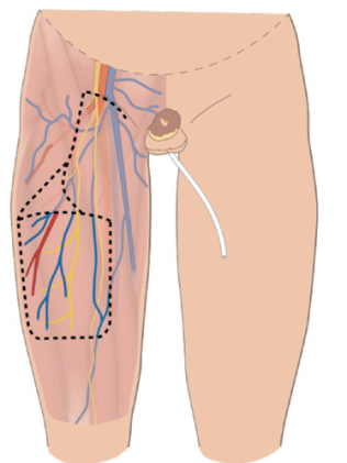 Picture 67, Afbeelding