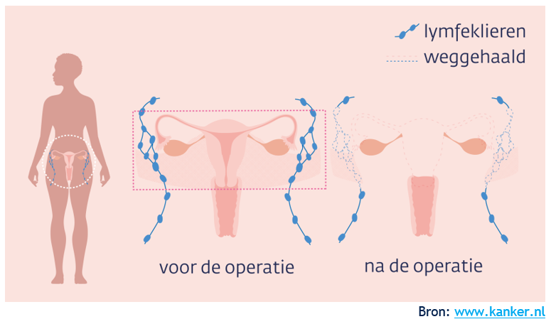 Afbeelding met tekst, schermopname
Door AI gegenereerde inhoud is mogelijk onjuist.