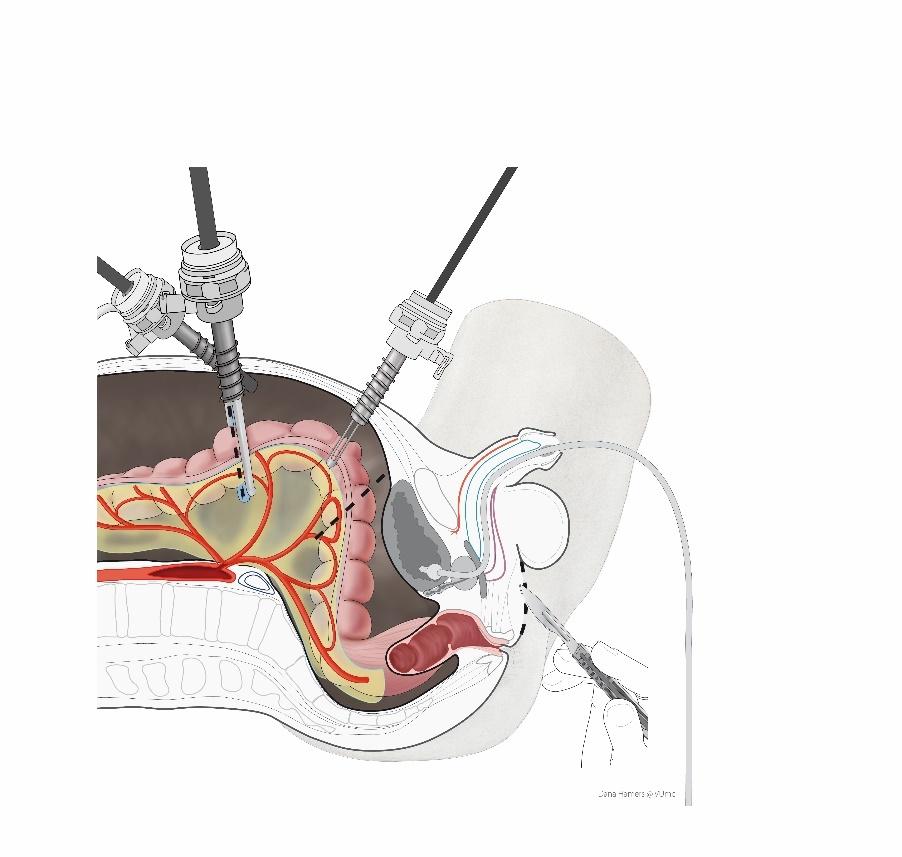 Afbeelding met schets, tekening, kunst, illustratie
Door AI gegenereerde inhoud is mogelijk onjuist.