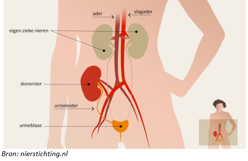 Afbeelding met schermopname, joint, skelet
Automatisch gegenereerde beschrijving