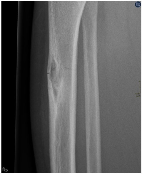 Afbeelding met röntgenfilm, Medische beeldbewerking, radiologie, radiografie
Door AI gegenereerde inhoud is mogelijk onjuist.
