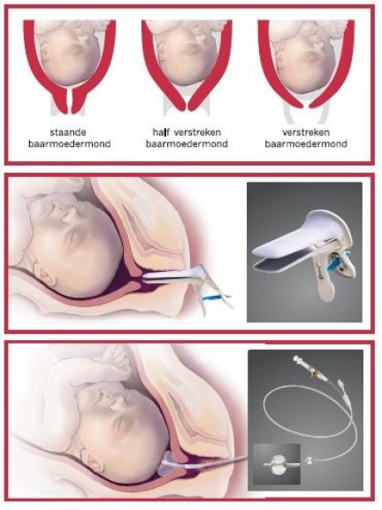 fases van de baarmoedermond