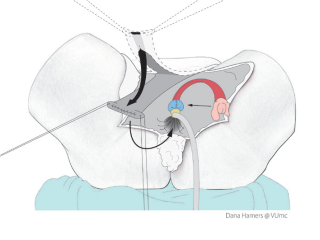 Picture 241, Afbeelding