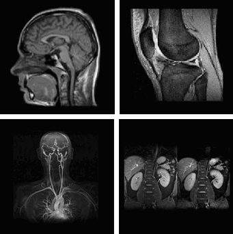 Afbeelding met röntgenfilm, Medische beeldbewerking, radiologie, radiografie
Automatisch gegenereerde beschrijving