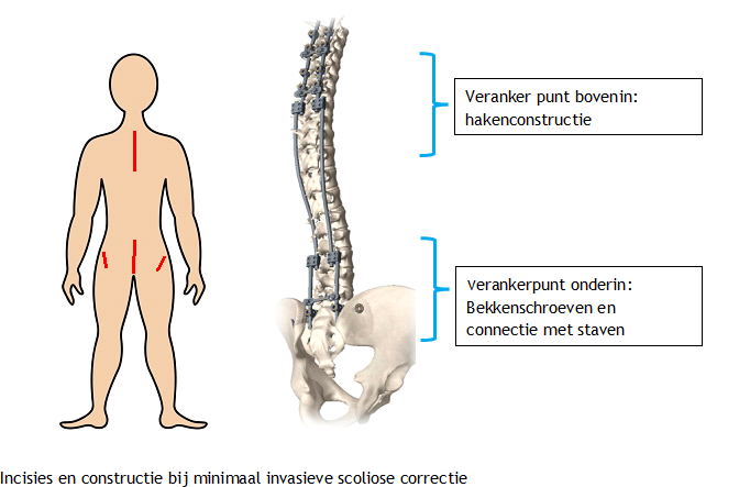 Afbeelding met tekst, schets, tekenfilm, skelet