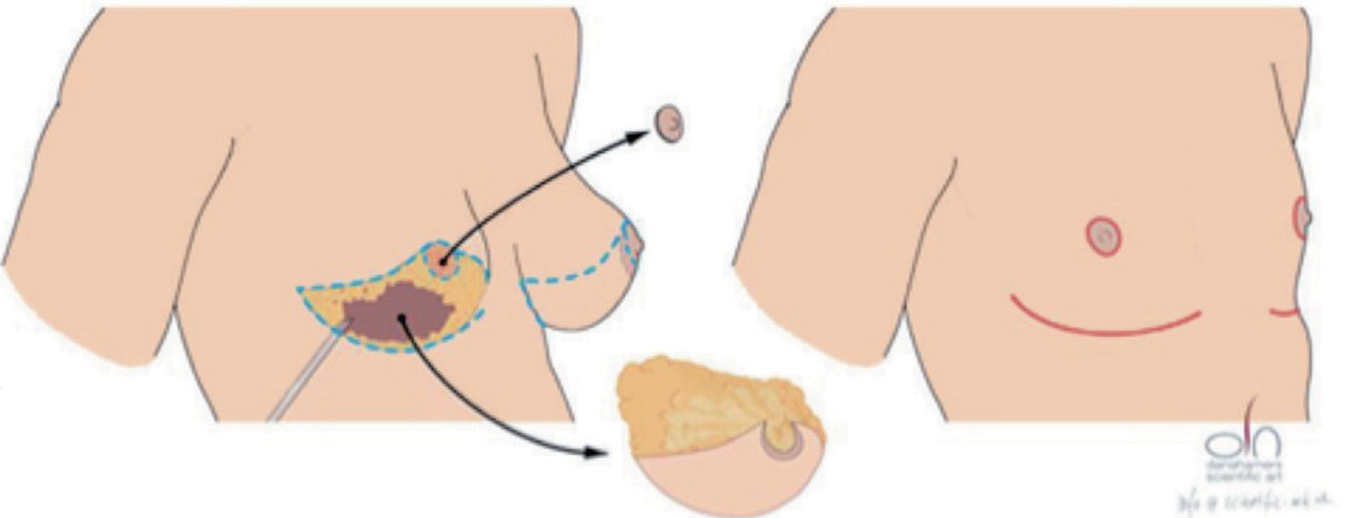 Dubbele snede-techniek, Afbeelding