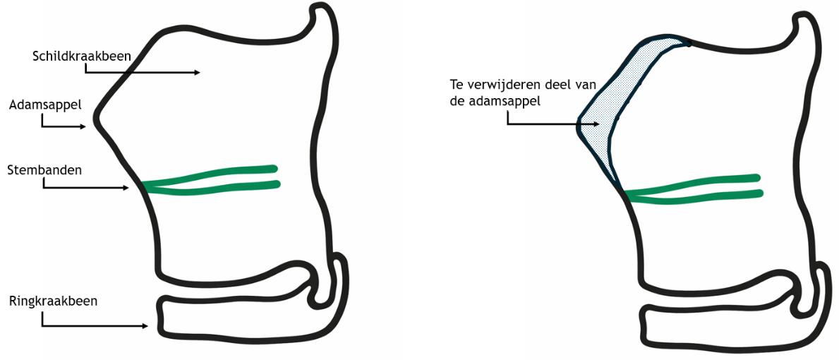 Afbeelding met schets, tekening, diagram, wit